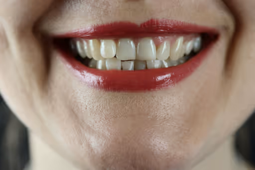Smile 3