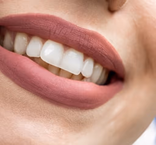 Smile 26